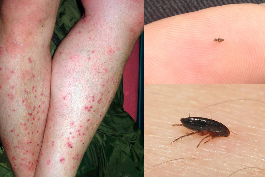 Блохи — это не только неприятные насекомые, которые кусают и вызывают зуд, но и потенциальная угроза здоровью всей семьи. Они могут появиться в доме, где проживают животные, или попадать с улицы, быстро размножаться и доставлять множество проблем. Так что тема как вывести блохи в доме навсегда — актуальна для многих хозяев. В этой статье я расскажу о действенных методах, которые помогут избавиться от блох навсегда.
Почему блохи появляются в доме и почему их сложно вывести
Прежде чем разобраться с тем, как вывести блохи из дома, следует понять, почему они так быстро поселяются в жилище. Блохи — это паразиты, которые питаются кровью теплокровных существ: чаще всего домашних любимцев (собак, кошек), но могут и кусать людей. Если в доме есть животные, они могут приносить блох с улицы или других мест.
Блохи живут не только на теле животного, но и в окружающей среде: коврах, полу, щелях, мягкой мебели. Они откладывают яйца, которые не всегда видны, и могут оставаться в доме долго, даже если уже нет животного. Вот почему важно знать, как вывести блохи в доме, не ограничиваясь только обработкой любимца.
Особенности жизни блох и почему важно уничтожать все стадии их развития
Блохи — это очень выносливые насекомые с интересным циклом развития: яйцо → личинка → куколка → взрослая особь. Вывести только взрослых насекомых — значит оставить для дальнейшего развития целое потомство. Яйца и личинки почти невидимы невооруженным глазом и могут долго оставаться в вашем доме, ожидая благоприятных условий.
Поэтому, когда вы узнаете, как избавиться от блох в доме, учитывайте, что нужно применять средства, действующие не только на взрослых, но и на личинки и яйца. Многие современные инсектициды обладают такими свойствами или же можно использовать комбинацию препаратов.
Эффективность профилактики и правильное отношение к домашним питомцам
Если у вас кошки или собаки, очень важно регулярно обрабатывать их специальными средствами от паразитов. Это может быть капля на холке, специальный шампунь или ошейник. Часто блохи попадают в дом именно из-за домашних животных, поэтому пропускать этот этап не стоит.
Также любимцы должны иметь свое чистое место для сна, которое регулярно убирают и проветривают. Следите, чтобы они не гуляли в местах большого скопления беспризорных животных, где есть большая вероятность заражения.
Народные методы стоит ли их использовать?
Некоторые хозяева ищут более безопасные способы и обращаются к народным средствам: уксус, эфирные масла, сода, раствор мыла. Они могут помочь немного отпугнуть блох или облегчить зуд у животных, но это обычно не является панацеей. Чаще такие методы — это дополнительное средство наряду с химической обработкой.
Если вы хотите испытать народные методы, используйте их как вспомогательные и не забывайте об основных шагах борьбы.
Основные шаги, чтобы избавиться от блох в доме навсегда
Вывести блох из дома можно, если системно подходить к проблеме, комбинируя механическую уборку, химическую обработку и профилактику. Ниже приведу список главных действий, которые помогут уничтожить насекомых на всех стадиях жизни.
Прежде чем ознакомиться со списком, важно понимать: если пропустить хотя бы один этап, блохи появятся снова. Поэтому не ленитесь делать все поочередно и в комплексе.
Основные шаги для выведения блох в доме:
1.	Тщательная уборка — основа борьбы. Пылесосите пол, ковры, мебель, особое внимание уделите местам, где любят лежать животные.
2.	Стирка всех текстильных изделий — подушек, одеял, пледов, покрывал — при температуре не ниже 60 °C.
3.	Обработка животных специальными средствами от блох — шампунями, каплями, спреями.
4.	Использование инсектицидов для отделки пола, мебели и ковров.
5.	Проветривание и солнечное облучение помещений — блохи не любят свет и сухость.
6.	Регулярный контроль и повторение процедур для полного уничтожения личинок и яиц.
Этот список следует рассматривать как пошаговый план, отвечающий на вопросы как вывести блохи в доме навсегда.
Какие средства и методы наиболее эффективны для выведения блох
Рынок предлагает множество препаратов и устройств, обещающих быстро и навсегда уничтожить паразитов. Но не все методы одинаково эффективны, а некоторые могут быть опасны для здоровья людей и животных. Рассмотрим самые популярные средства.
Химические инсектициды
Это более распространенный и действенный способ. Сюда входят:
●	Спреи для обработки помещений.
●	Порошки и аэрозоли.
●	Специальные средства для животных (капли, шампуни, ошейники).
При выборе препарата важно учитывать состав, рекомендации производителя и безопасность. Лучшие средства обладают комбинированным действием — они убивают и взрослых особей, и личинки.
Народные методы
Некоторые пользуются эфирными маслами (лаванда, эвкалипт), уксусом, содой, чтобы отпугнуть или снизить количество блох. Они могут дополнять основное лечение, но не заменят профессиональную обработку.
Пошаговый план действий: как избавиться от блох в доме быстро и надолго
Для удобства приведен подробный алгоритм, который поможет решить проблему без лишних хлопот:
Шаг 1: Уборка
Начните с уборки. От пылесоса невозможно убежать — он собирает взрослых блох, их яйца и личинки. Пылесосите тщательно все поверхности, особенно под кроватями, диванами, у животных лежаков.
Шаг 2: Стирка текстиля
Стирка при высокой температуре убивает личинки и яйца. Соберите все ткани, контактирующие с животными, и постирайте.
Шаг 3: Обработка животных
Даже если в доме нет домашних любимцев, часто источником блох являются беспризорные кошки или собаки, которые иногда заходят во двор. Если у вас есть животные, обработайте их специальными средствами.
Шаг 4: Химическая обработка помещения
Выберите инсектицидный спрей или аэрозоль, внимательно прочтите инструкцию и обработайте все места обитания блох: ковры, щели, пол, мягкую мебель. Не забывайте о проветривании после обработки.
Шаг 5: Профилактика
Регулярно пылесосьте, проветривайте помещение и периодически повторяйте отделку — это предотвратит появление новых блох.
Полезные советы, которые помогут избежать повторного заражения
Даже после успешного вывода блох очень важно соблюдать определенные правила, чтобы не сталкиваться с ними снова.
●	Периодически осматривайте животных, используйте профилактические средства.
●	Не оставляйте во дворе мусор, где могут прятаться грызуны или бездомные животные.
●	Часто пылесосьте и мойте полы.
●	Вовремя выводите блох и на улицы — летом они активны особенно.
Теперь вы знаете, как вывести блохи в доме навсегда — это комплексный процесс, объединяющий механические, химические методы и профилактику. 
