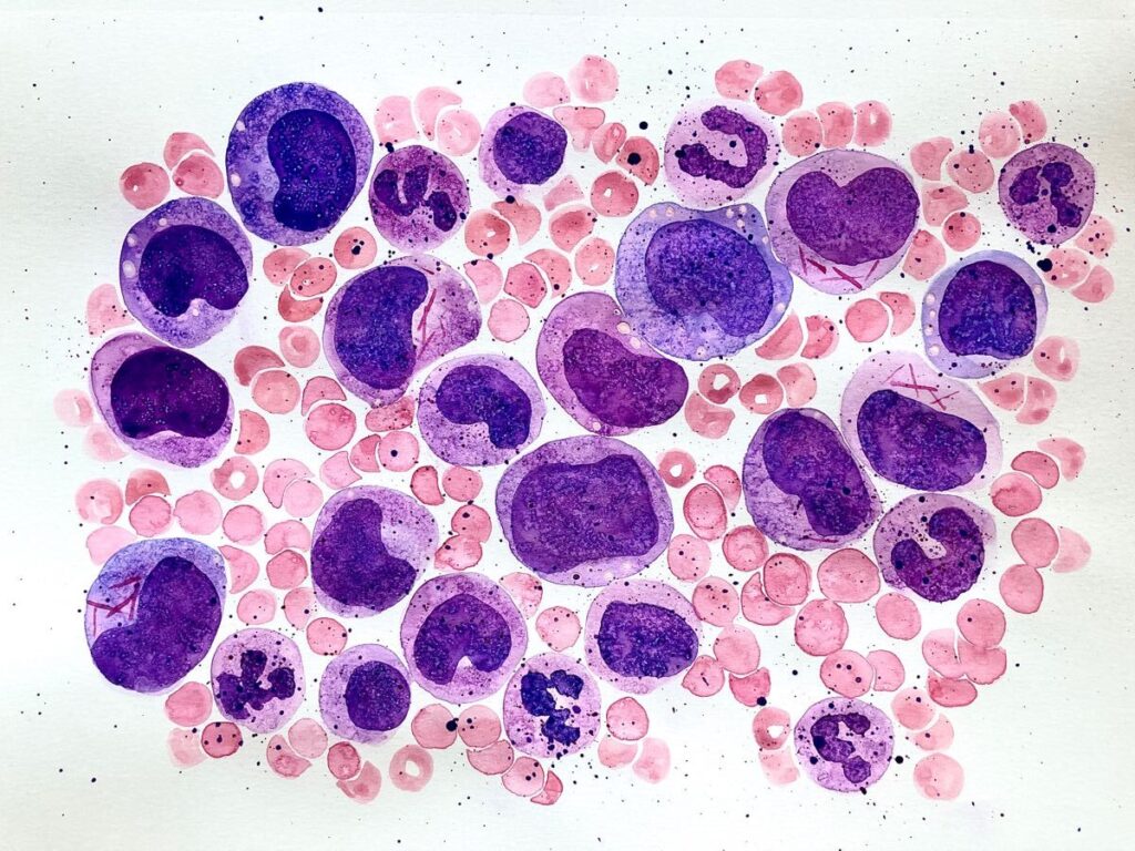 Базофилы: что это такое, какова их норма и о чем свидетельствуют отклонения